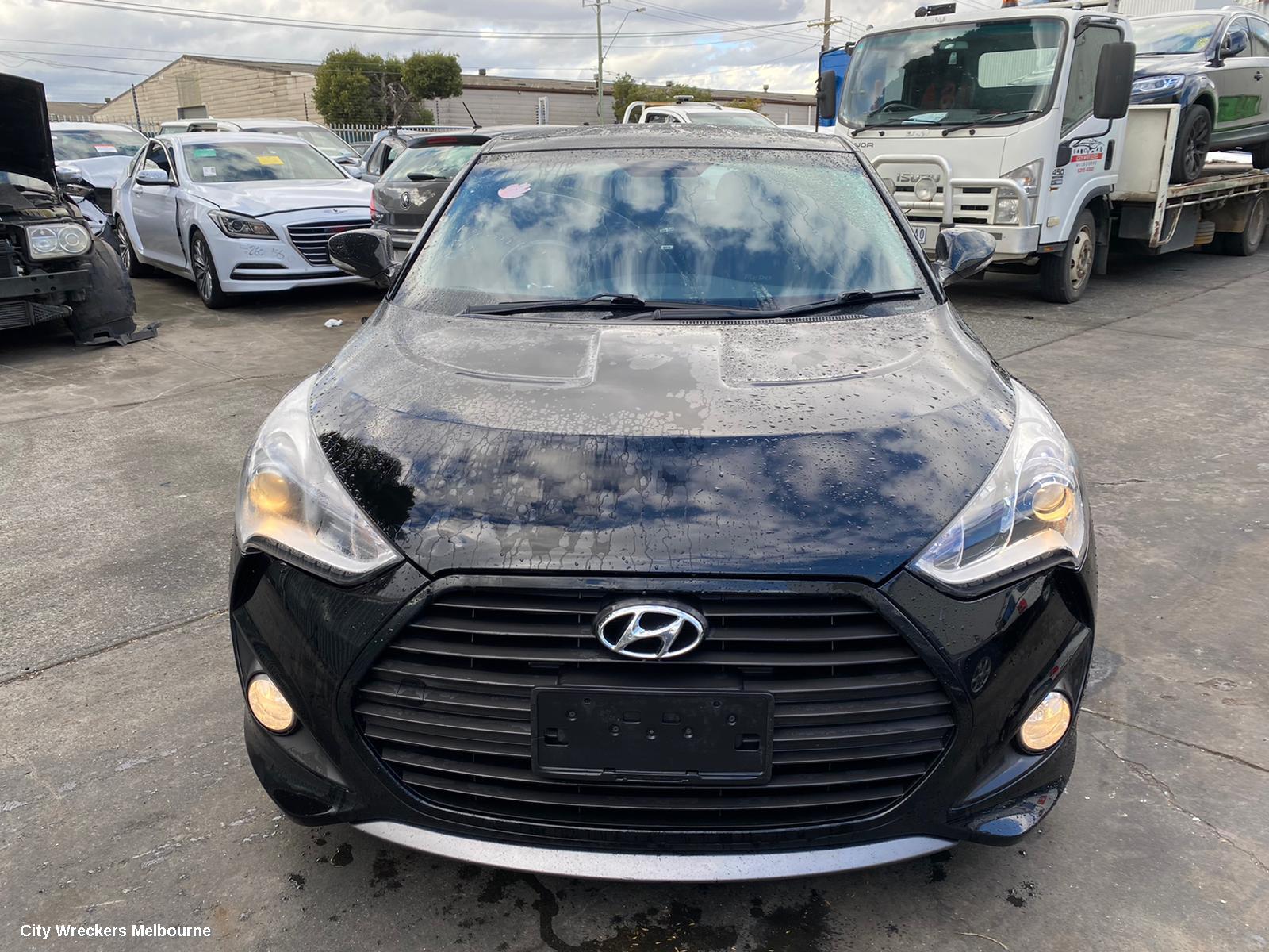 HYUNDAI VELOSTER ABS SENSOR, RH FRONT, FS, 12/2011 - 02/2018