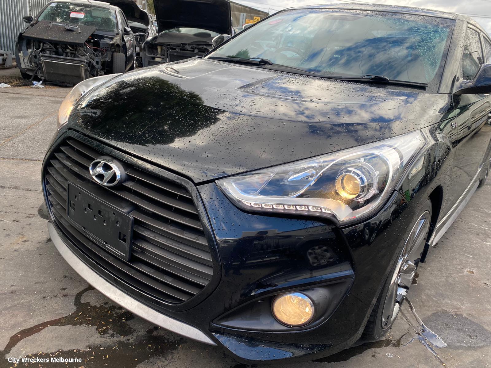 HYUNDAI VELOSTER ABS SENSOR, RH FRONT, FS, 12/2011 - 02/2018