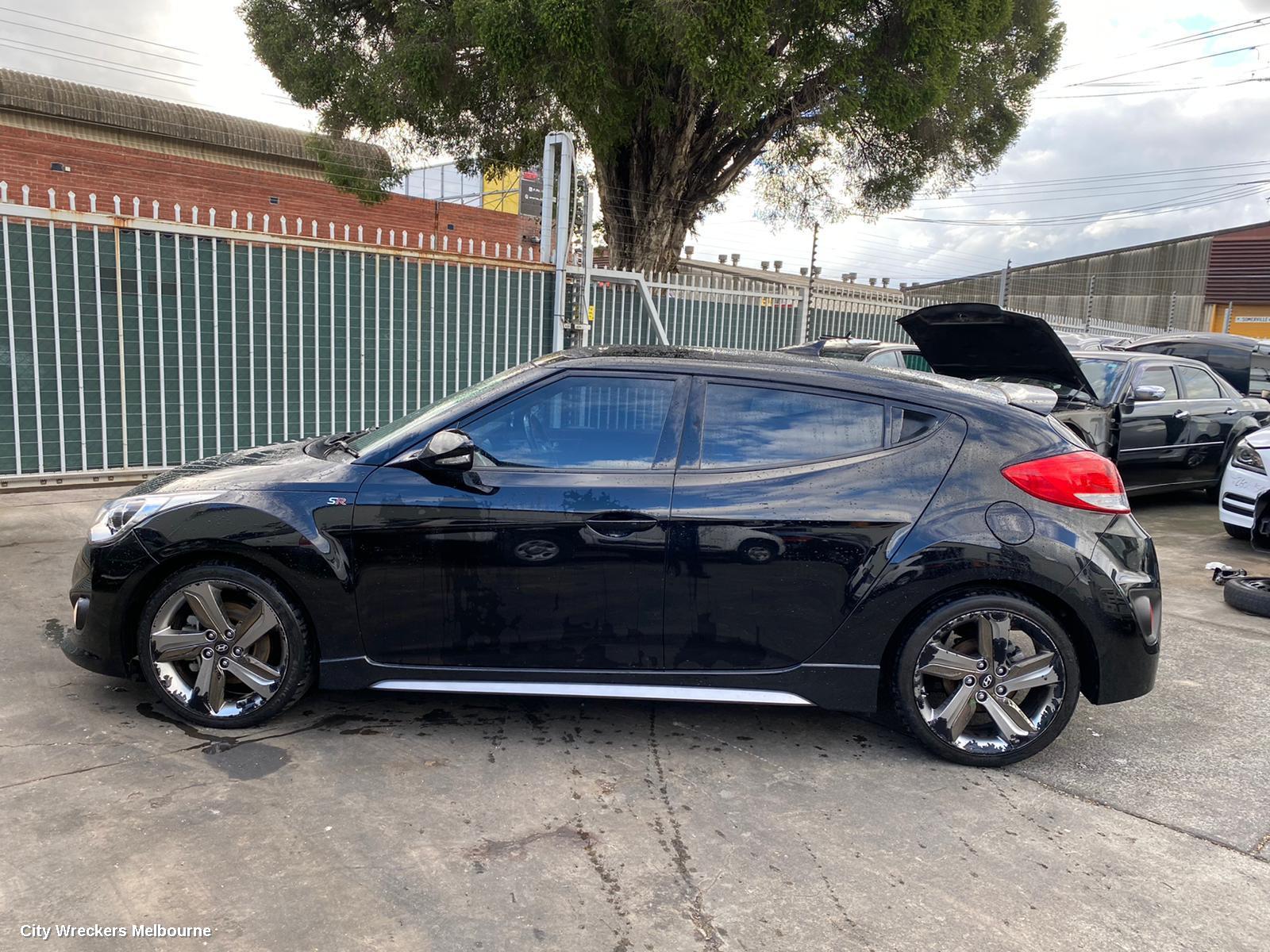 HYUNDAI VELOSTER ABS SENSOR, RH FRONT, FS, 12/2011 - 02/2018