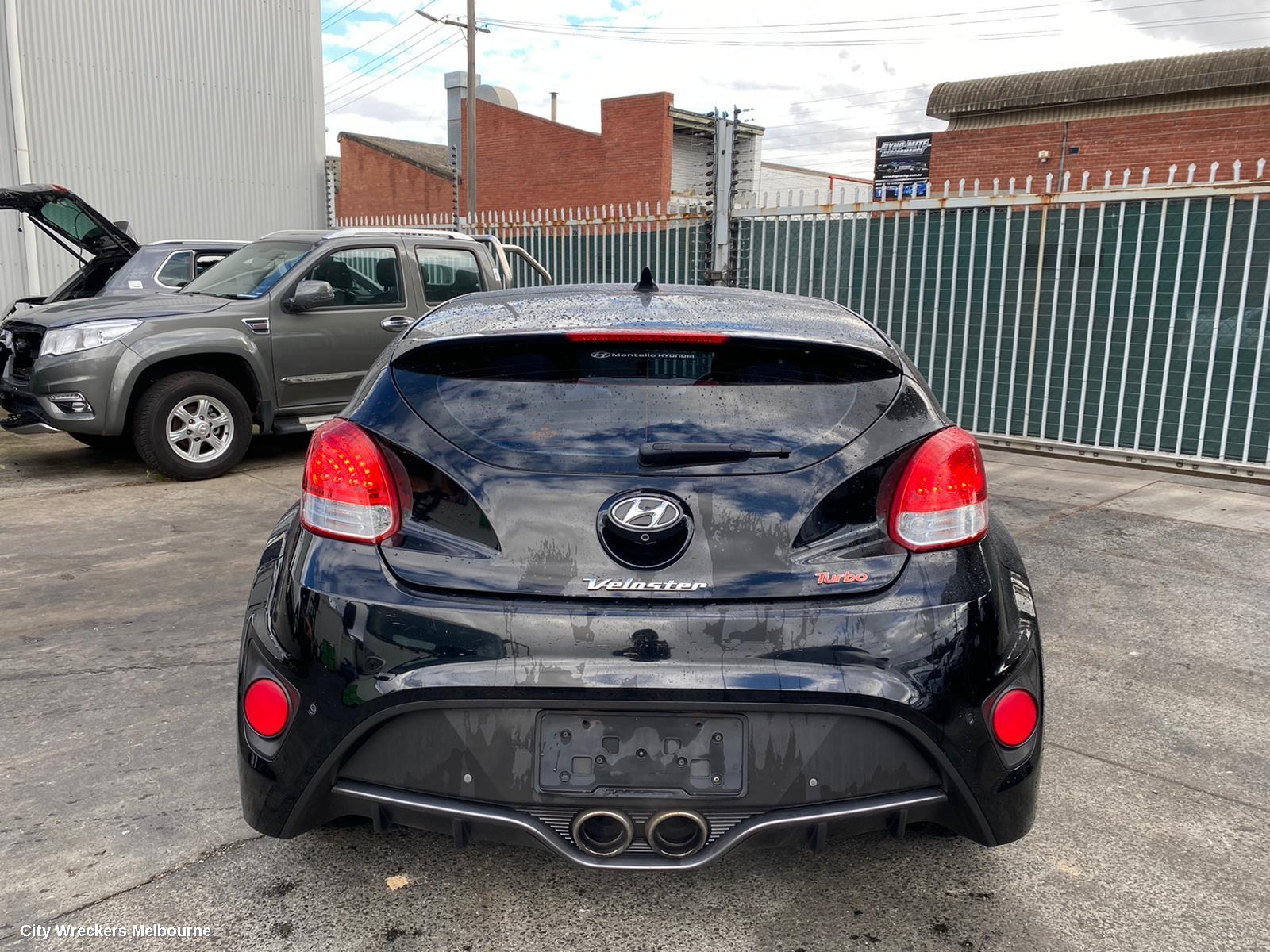 HYUNDAI VELOSTER ABS SENSOR, RH FRONT, FS, 12/2011 - 02/2018