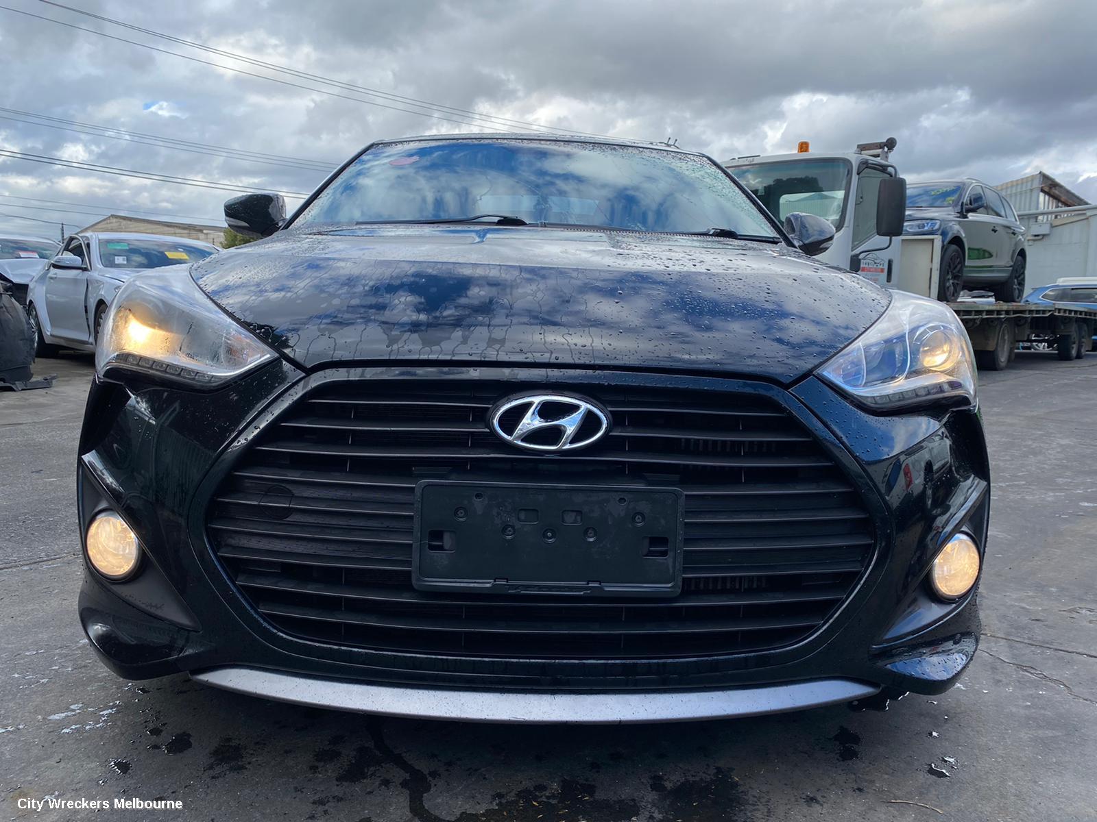 HYUNDAI VELOSTER ABS SENSOR, RH FRONT, FS, 12/2011 - 02/2018