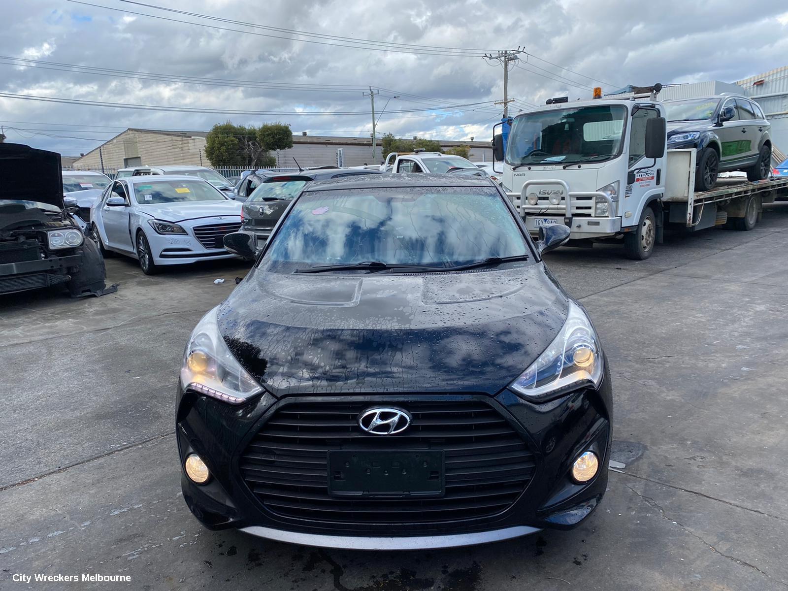 HYUNDAI VELOSTER ABS SENSOR, RH FRONT, FS, 12/2011 - 02/2018